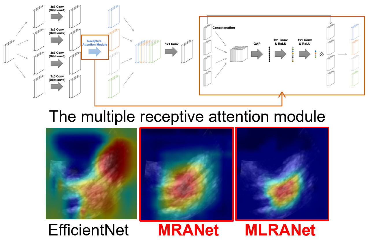 Our paper accepted to Computers in Biology and Medicine.